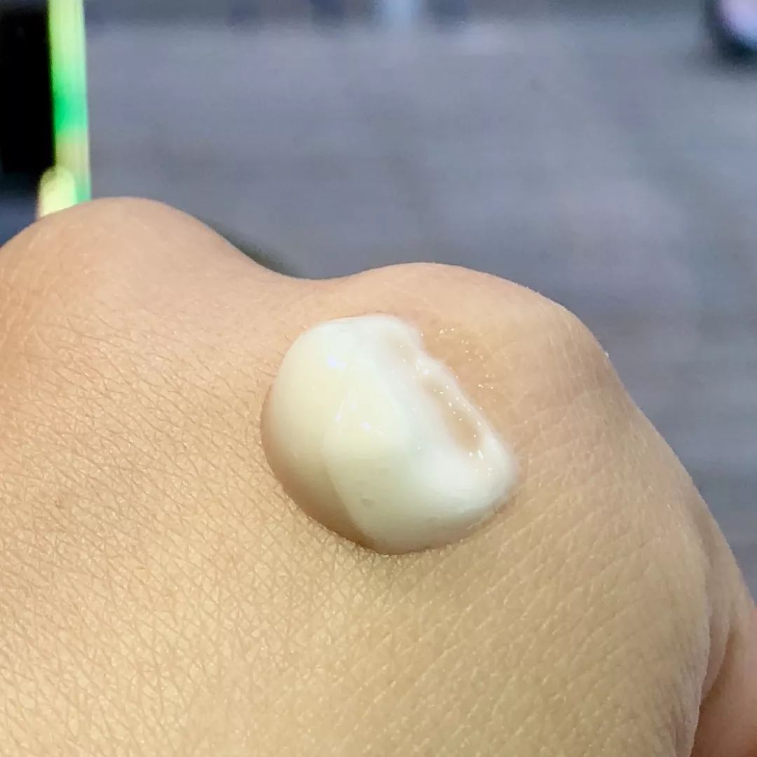 108块就能治好脸，感觉之前的钱都白花了