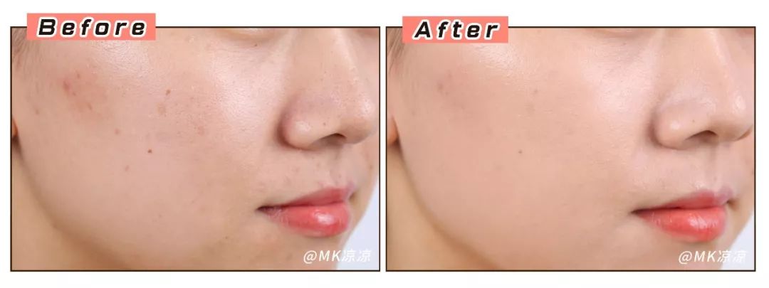 双十一购买skii怎么买划算,sk-ii哪些单品值得买