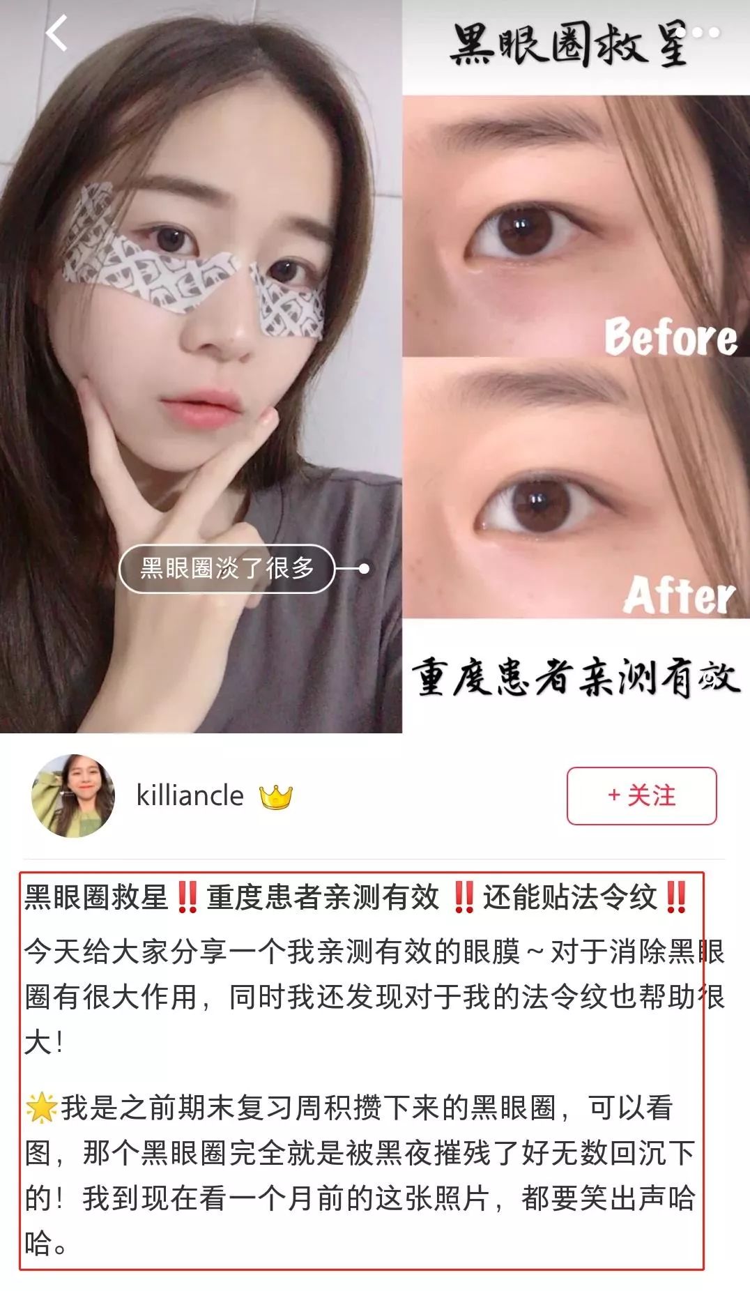 半个娱乐圈都在用的眼膜,熬夜党必备的眼膜一盒足足60片