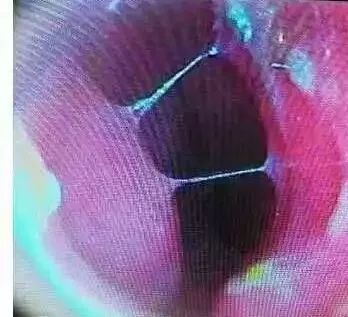 四退原则出炉：“无论什么原因，鼻炎治不好就退款！”常州这家诊所打了谁的脸？