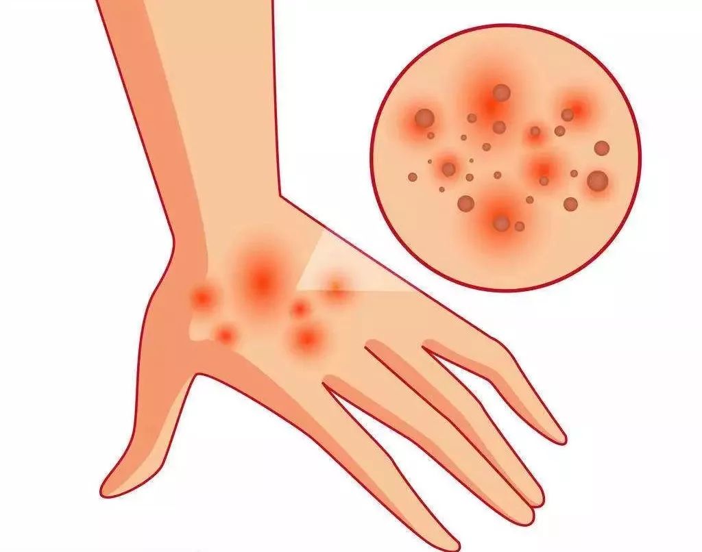 药店里几毛钱的药膏,竟能缓解治疗12种常见病痛!不看亏大啦~