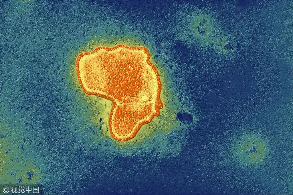 安全用药这30种药儿童禁止用慎用,药说明书上写儿童禁用可以用吗