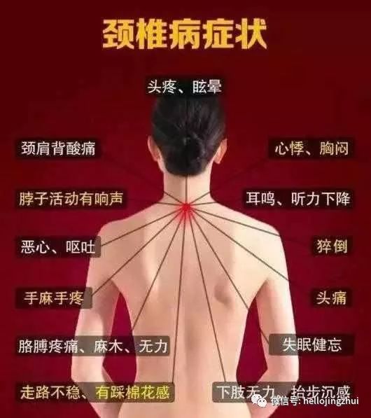 颈椎病压迫神经吃甲钴胺多长时间,颈椎病压迫神经微创手术要多少钱