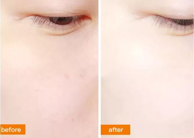 安瓶补水紧致提拉去皱精华,嫩白抗皱安瓶精华