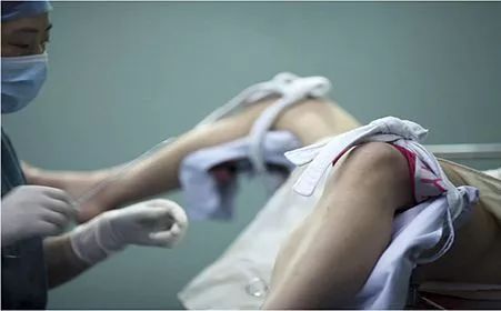 不同人流产,不同人群避孕方法的选择宣传册