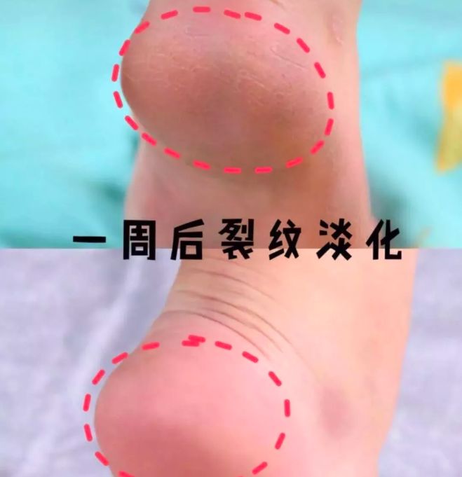 手部护理保养精油,spa护理手套