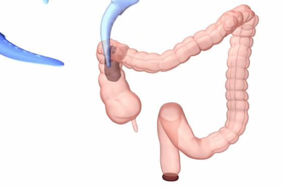 便秘是怎么回事能看好吗,便秘的表现与症状怎么解决