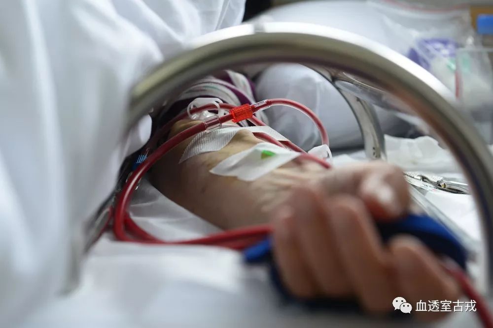 透析穿刺针脱落整改措施,透析过程中穿刺针滑脱怎么办