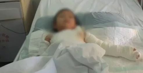 奶奶转个身，女孩烫掉一层皮严重休克...咋回事？每个家长都该看看