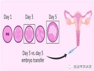 做试管婴儿的具体步骤有哪些,试管婴儿是怎么样的一个流程