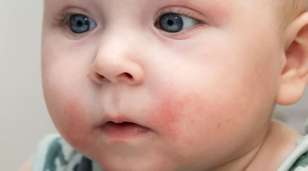 告别秋冬干燥肌肤,告别小糙脸