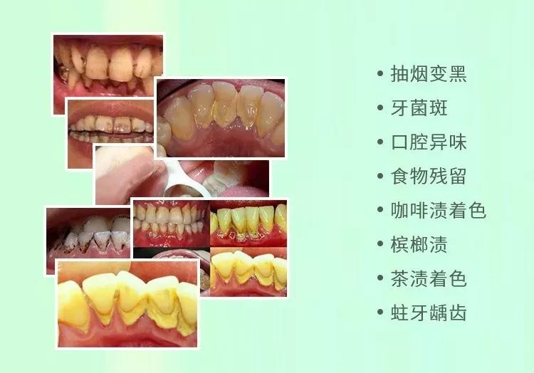 闭着嘴巴一会就干有异味,闭着嘴巴都感觉口腔有异味