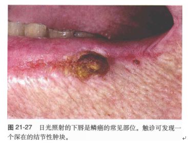 你说不“痣”道的事！