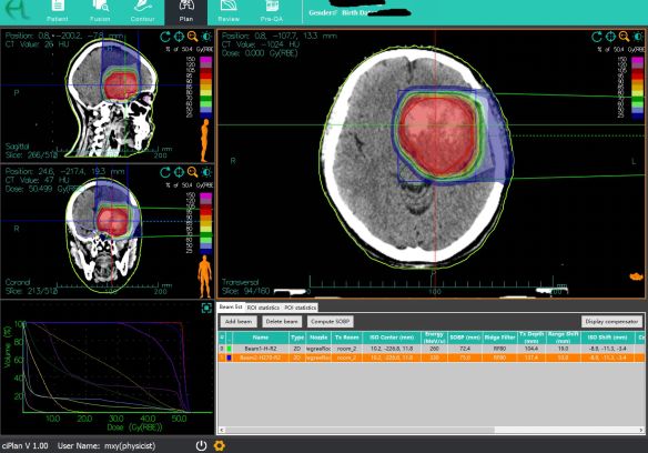 武威重离子中心放疗一科,甘肃武威市医院放疗科