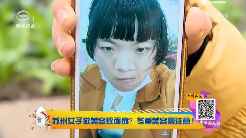 女子整容后惊呆医生,做美容致面瘫