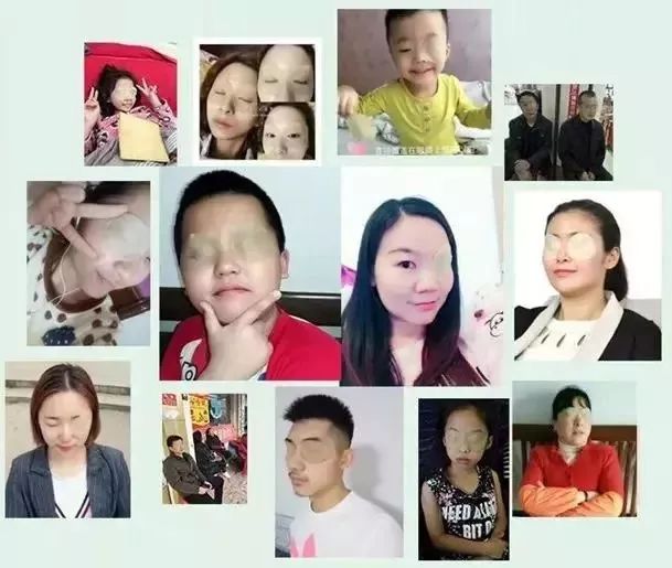 每天眼上敷一片，眼不花看得清，再也不怕近视了，男女老少都爱！