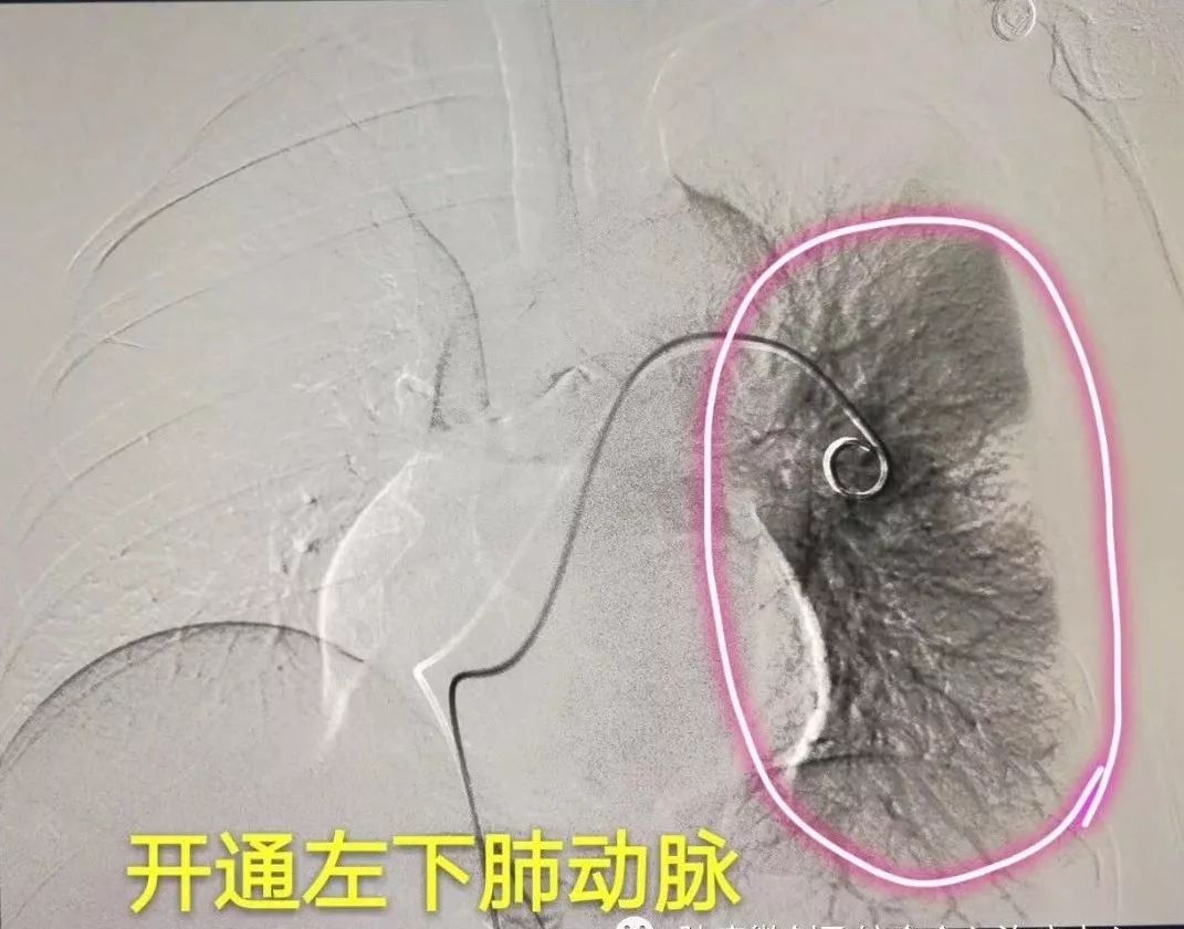 运城市第一医院肿瘤科咋样,运城第一医院治疗肿瘤怎么样