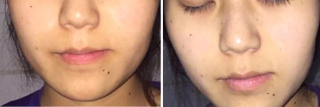 女明星喝的酵素减肥,女明星都在吃的酵素