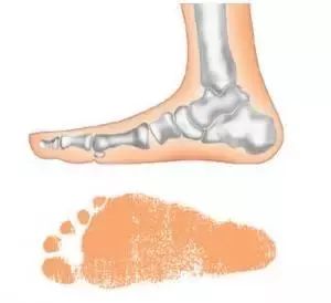 儿童适不适合穿雪地靴,儿童为什么不建议穿雪地靴