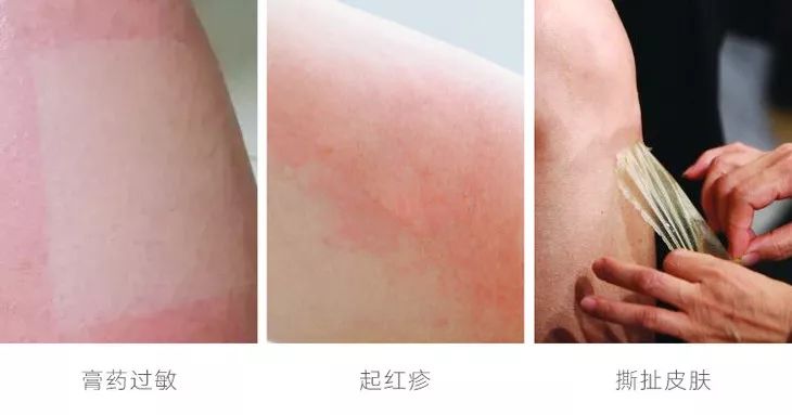 脖子后颈僵硬酸痛怎么缓解,脖子肩膀僵硬酸痛买什么膏药