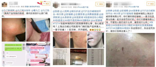 吸血的微商面膜生意：除了顶部的那些人，根本没人能赚到钱