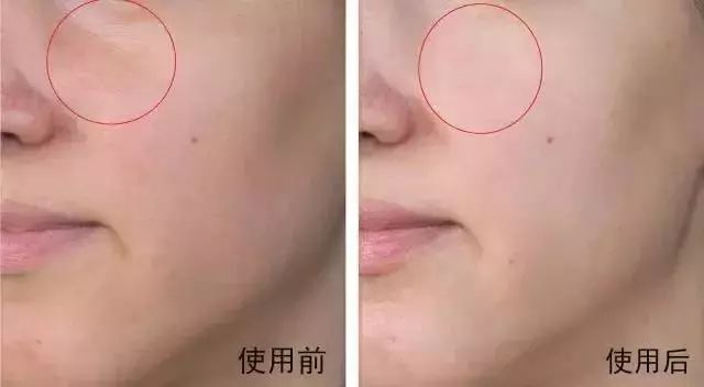 让肌肤重获新生,活肤水排行榜10强抗衰老