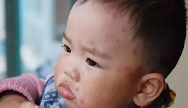 湖北是不是爆发了流感,湖北人警惕