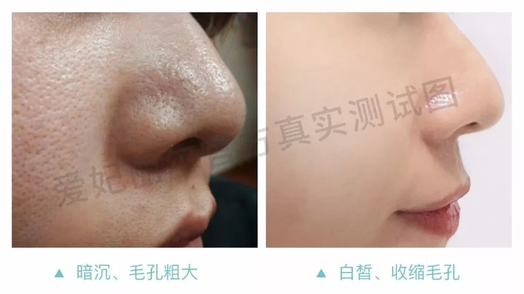 娱乐圈年近50岁不老的秘密曝光，原来只是做好了这一点！