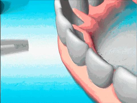 到底应不应该洗牙知乎,应该洗牙抛光吗