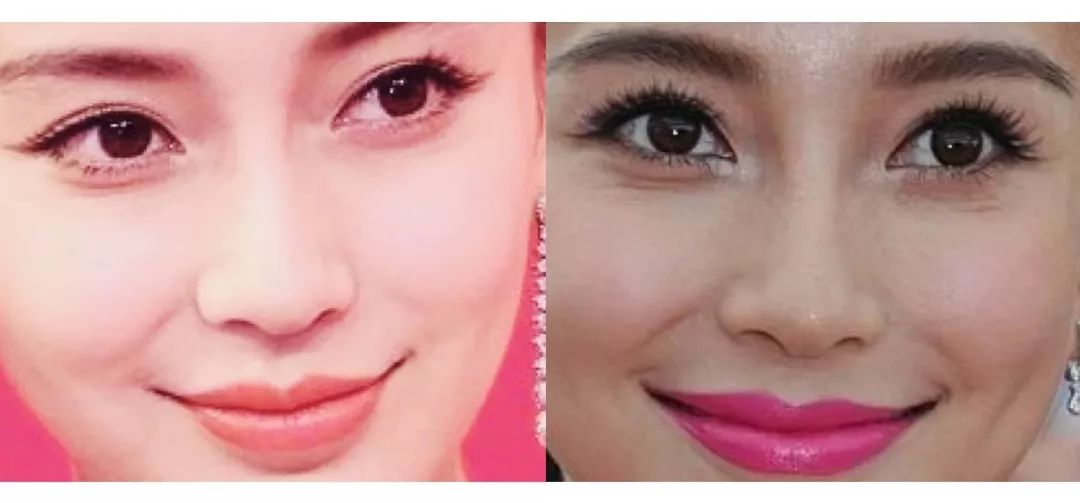 美容针真的可以祛法令纹吗,10块钱不到的成本去法令纹去皱