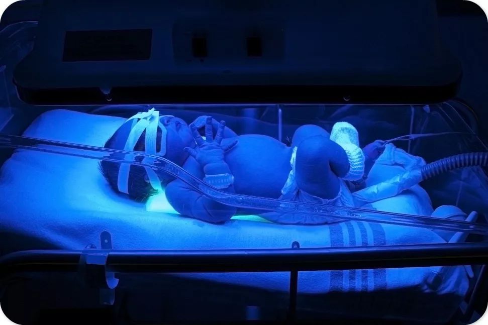 宝妈注意关于新生儿护理的三件事,新生儿常见病症新妈咪遇到别惊慌