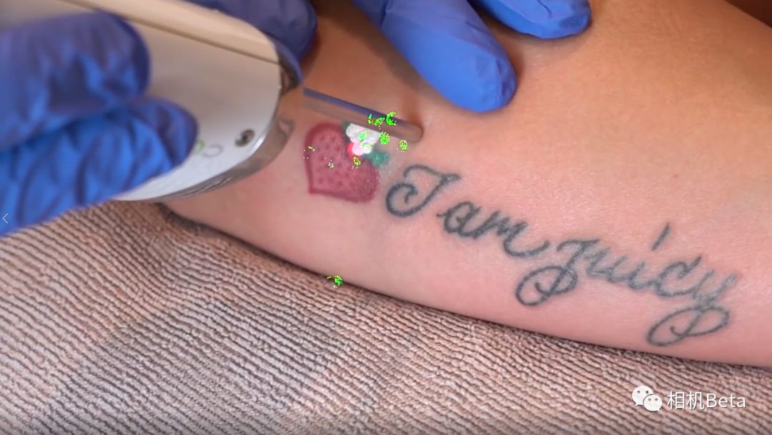 激光洗纹身真的不会留疤吗,索尼a7s2斑马纹