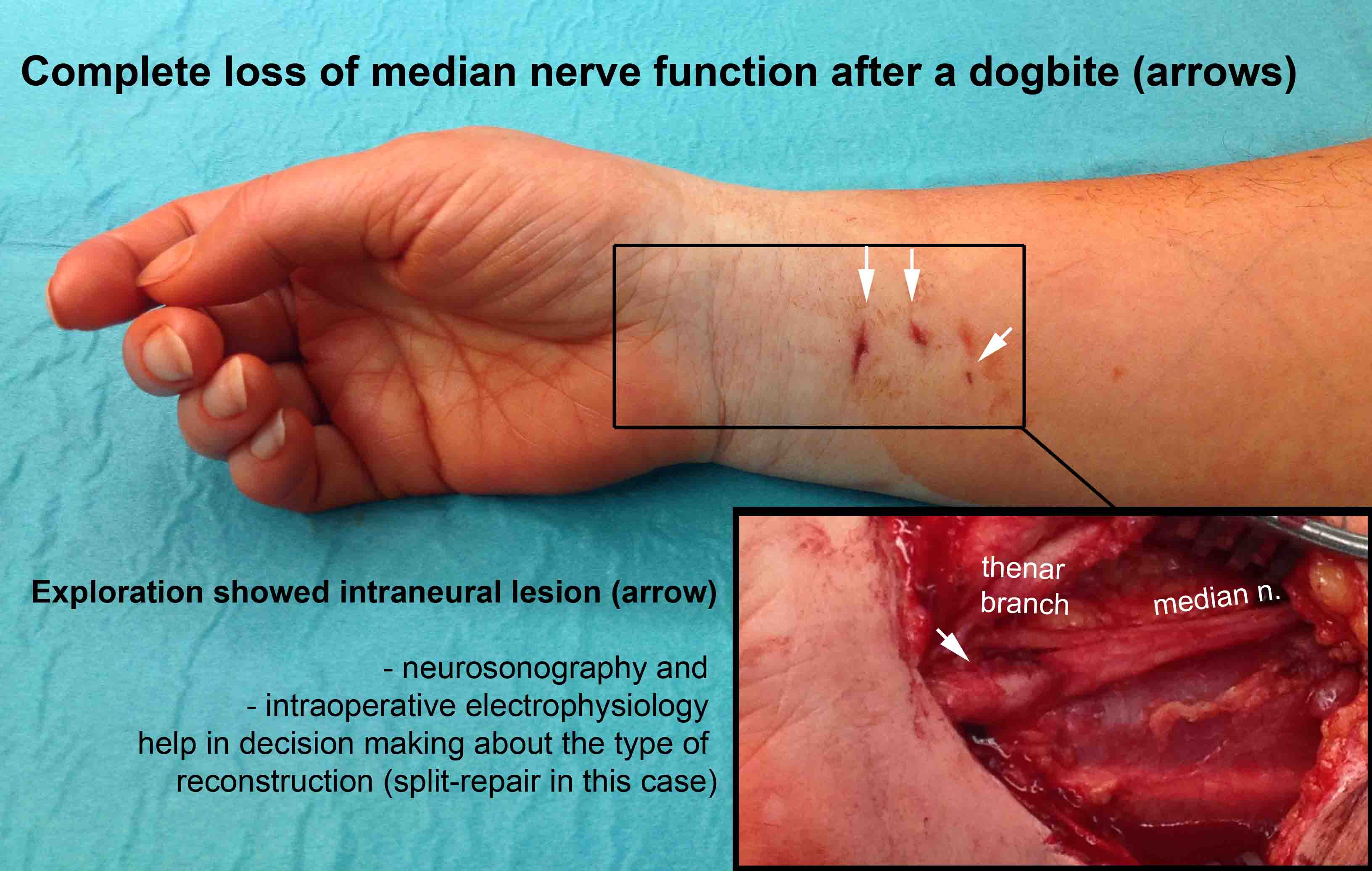 人体中弹会怎么样,人体中枪后果