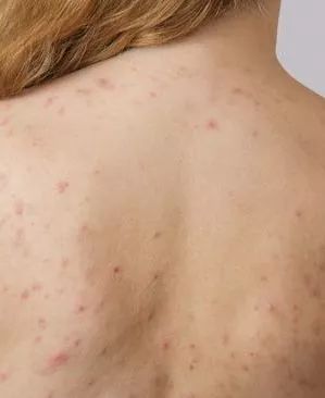 姑娘我看你印堂发黑下一句,姑娘我看你印堂发黑