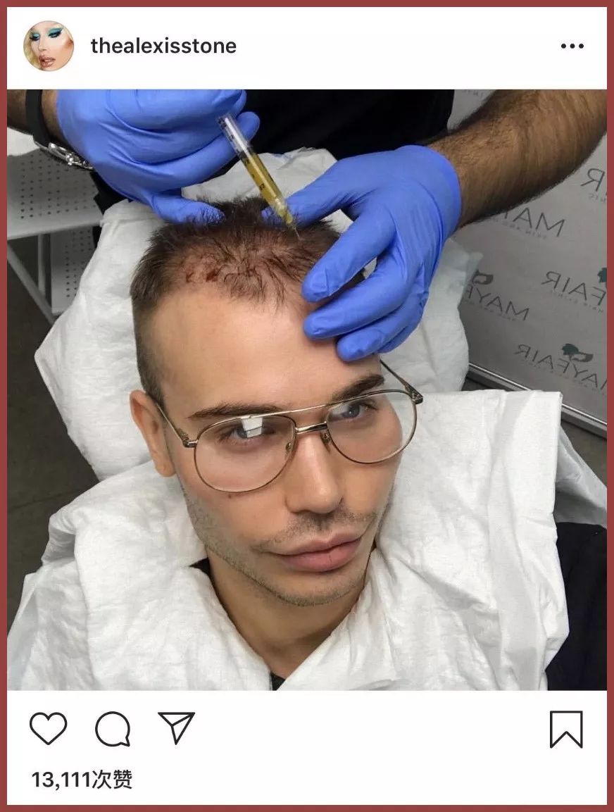 张雨绮猪油抹脸,张雨绮猪油膏