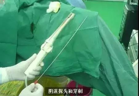 专骗年轻女性的「赌命交易」，希望永远不要发生在你身上