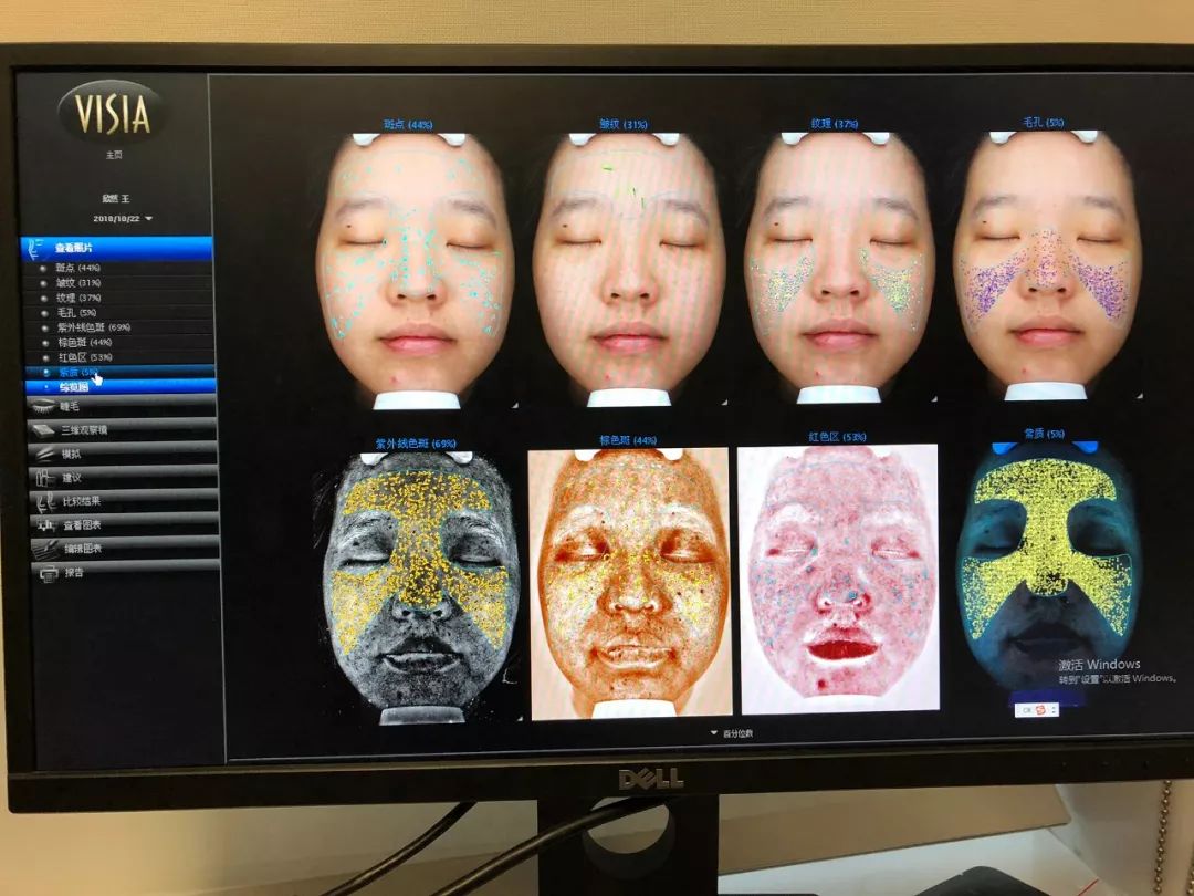 假小子变装惊艳全场的样子,肿眼泡假小子