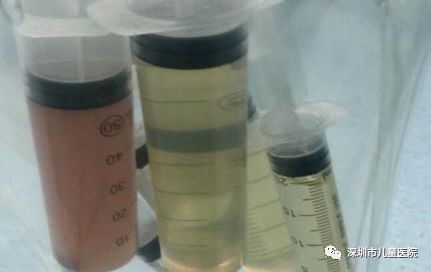 4岁娃肚大如孕妇，体内抽出2斤寄生虫液！铲屎官们注意，这虫能让你“狗带”