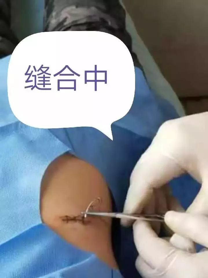 小小黑痣该不该治？该如何治？