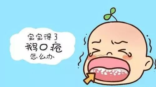 青岛妇幼治疗鹅口疮的药,妇幼治疗鹅口疮的药