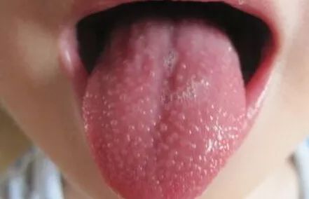 儿童季节性皮疹用什么药最好,儿童常见的出疹疾病