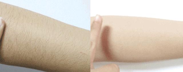 ⊙超管用!不用刮、零疼痛,轻轻一抹就能「快速脱毛」