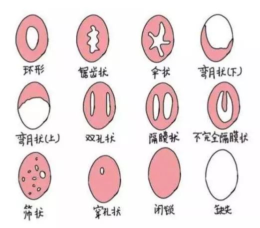 不要脸的护犊子,13岁男孩“欺负”6岁女孩,家长说他研究人体构造