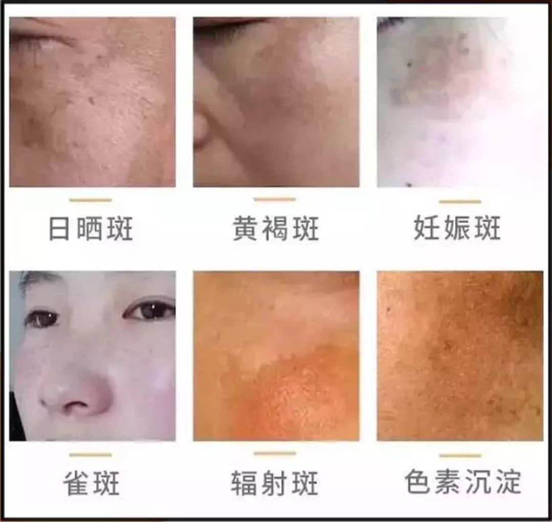 媲美大牌的平价面霜，不到一个月让我白了两度，连斑都看不见了！