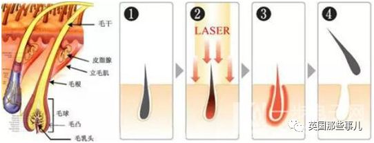 人类进化过程中体毛变少了,人类体毛为什么变少了