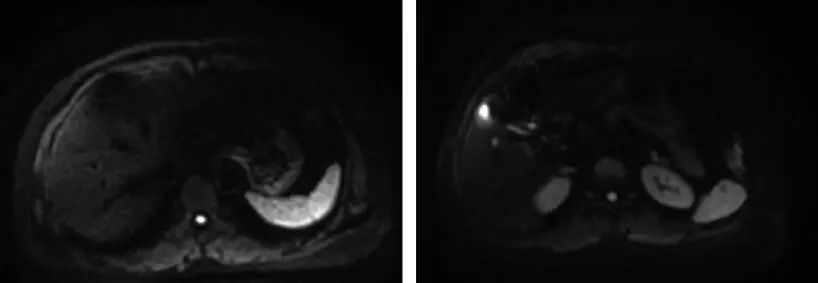 分子靶向治疗和基因靶向治疗,分子靶向治疗视频