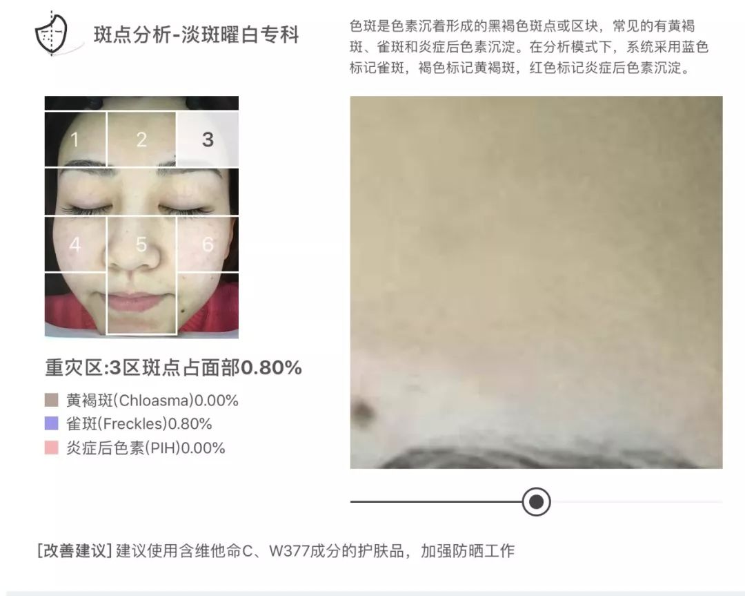 灏忚寕鑲岃瘖瀹よˉ姘村悧,灏忚寕鑲岃瘖瀹ゅ埌搴曟湁澶氬己