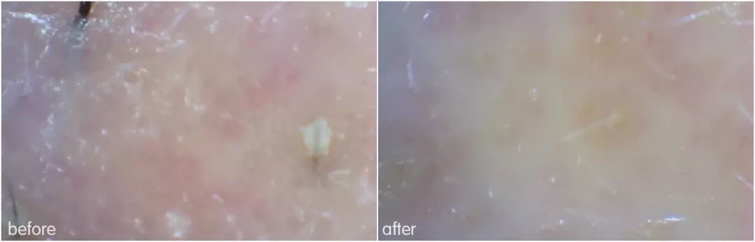 灏忚寕鑲岃瘖瀹ゅ埌搴曟湁澶氬己,灏忚寕鑲岃瘖瀹よˉ姘村悧