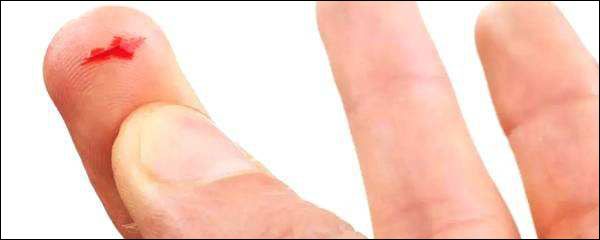 手指被纸割伤,被纸割伤为什么那么疼