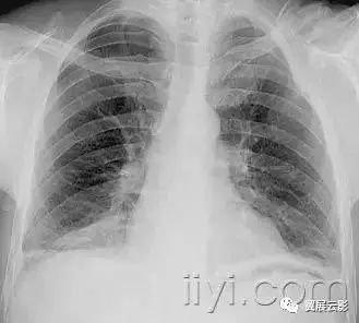 胸部解剖及常见疾病影像表现,胸部影像学基础知识